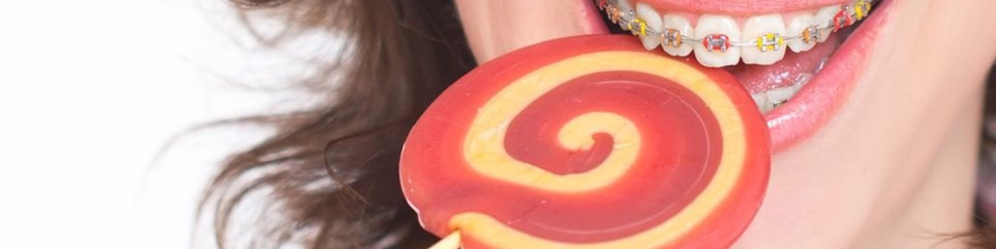 Centra Dental - Avoid Sticky Candy If Your Child Wears Houston Braces