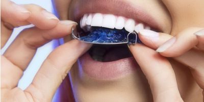 Centra Dental - What Happens After You Get Your South Houston Braces Off? Tips on Maintaining Your New Smile