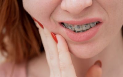 Centra Dental - How to Deal with Discomfort from South Houston Braces