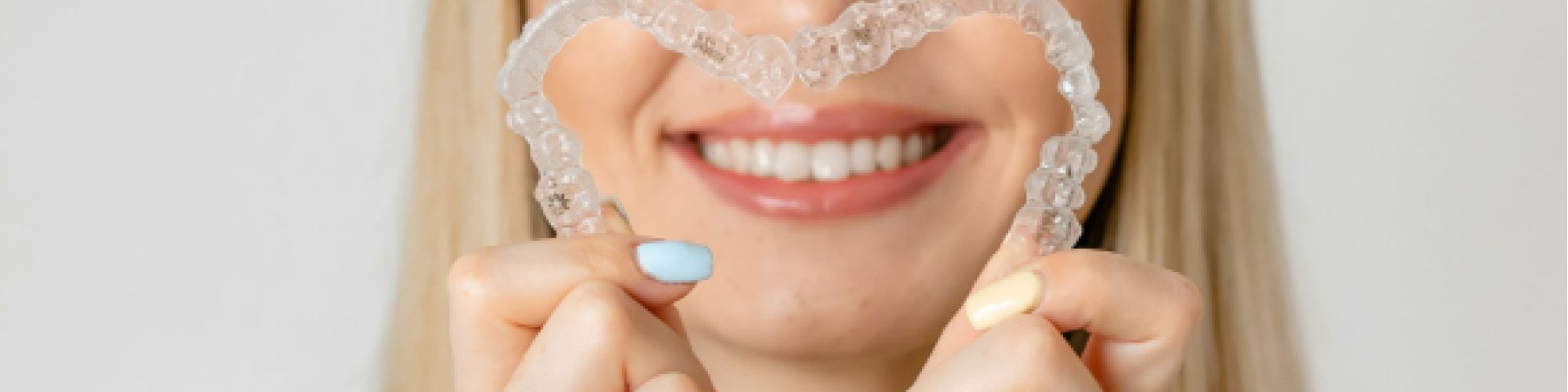 Centra Dental - How South Houston Invisalign Clear Aligners Work