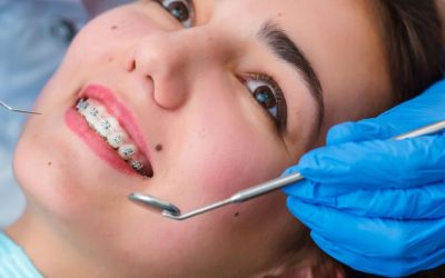 Centra Dental - Reasons to Consider Getting Houston Braces