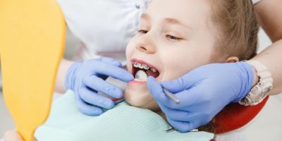 Centra Dental - How Old Does My Child Need to be in Order to Get Houston Braces