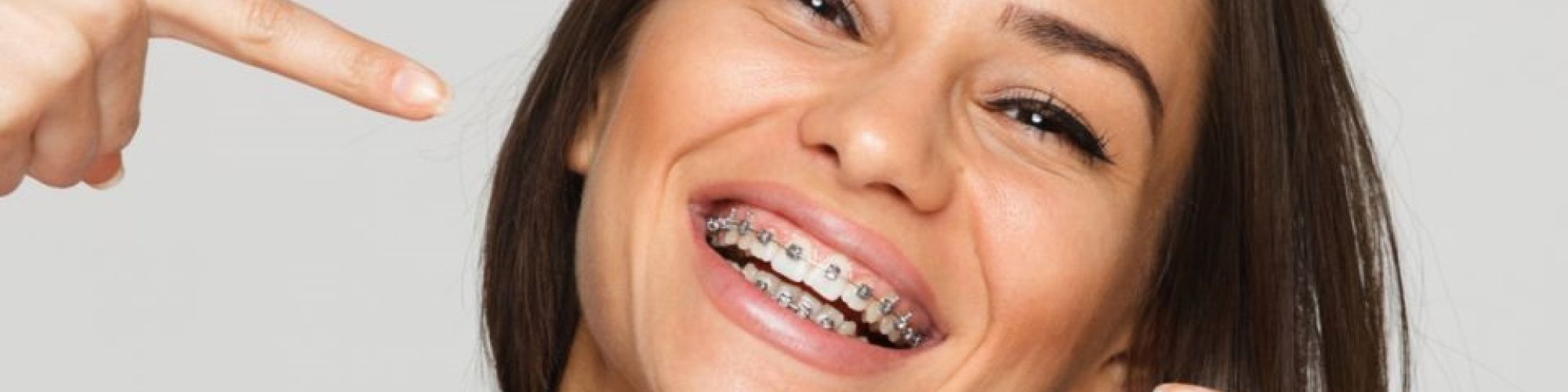 Centra Dental - How to Prevent Houston Braces from Breaking