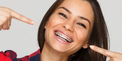 Centra Dental - How to Prevent Houston Braces from Breaking