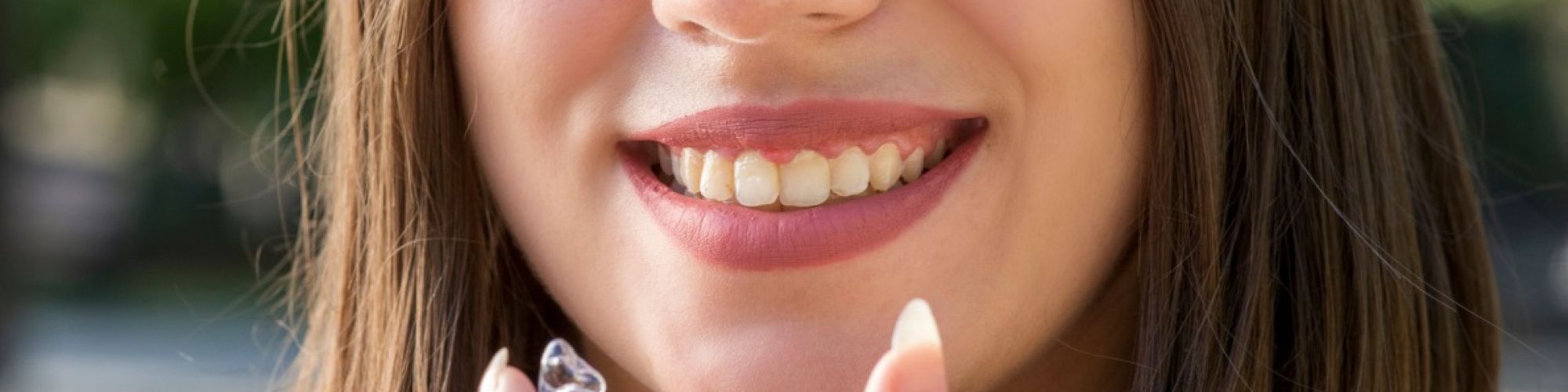 Centra Dental - Are Houston Clear Aligners Right for You?