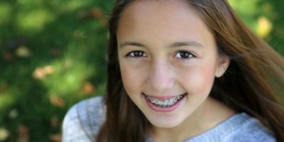 Centra Dental - Consider Early Houston Braces Treatment