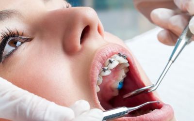 Centra Dental - Early Orthodontics Affected by Lack of Dental Visits