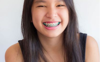 Centra Dental - When Can Your Child Get South Houston Braces?
