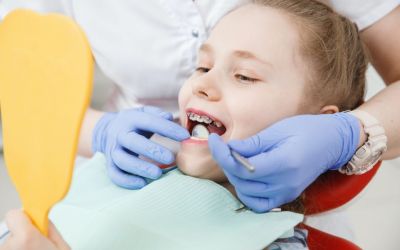 Centra Dental - How Old Does My Child Need to be in Order to Get Houston Braces