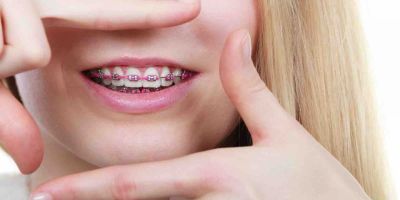 Centra Dental - Launch Your Spring with Braces