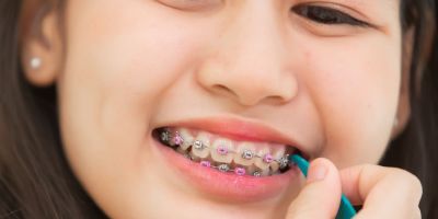 Centra Dental - Daily Habits to Optimize Your South Houston Braces Hygiene