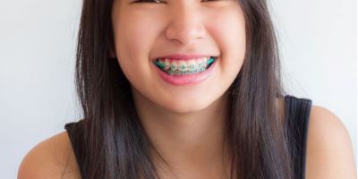 Centra Dental - When Can Your Child Get South Houston Braces?