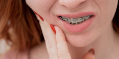 Centra Dental - How to Deal with Discomfort from South Houston Braces