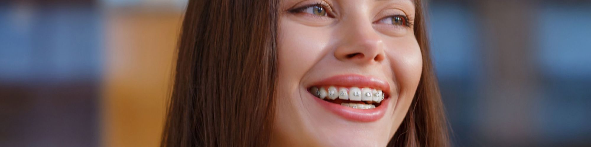 Centra Dental - Getting South Houston Braces: What to Expect the First Month