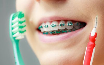 Centra Dental - Good Hygiene While Wearing Houston Braces