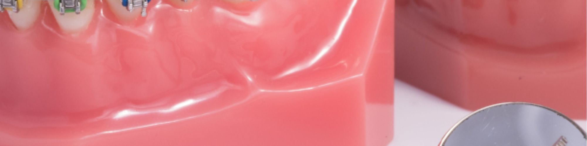 Centra Dental - Ceramic Houston Braces Versus Metal Braces