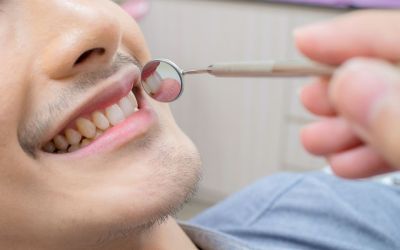 Centra Dental - All You Need to Know About Dental Benefits at Centra Dental in South Houston