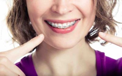 Centra Dental - Looking for Affordable Braces in Houston?