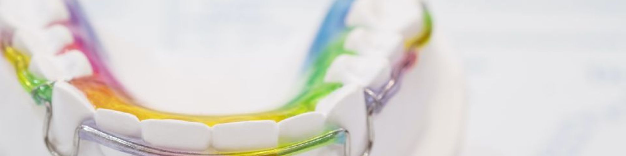 Centra Dental - Pros and Cons of Traditional Orthodontic Retainers After Houston Braces