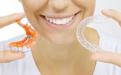 Centra Dental - Do You Need To Clean Your Orthodontic Retainers?