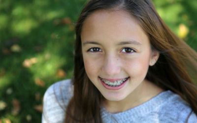 Centra Dental - Myths and Facts About Houston Braces