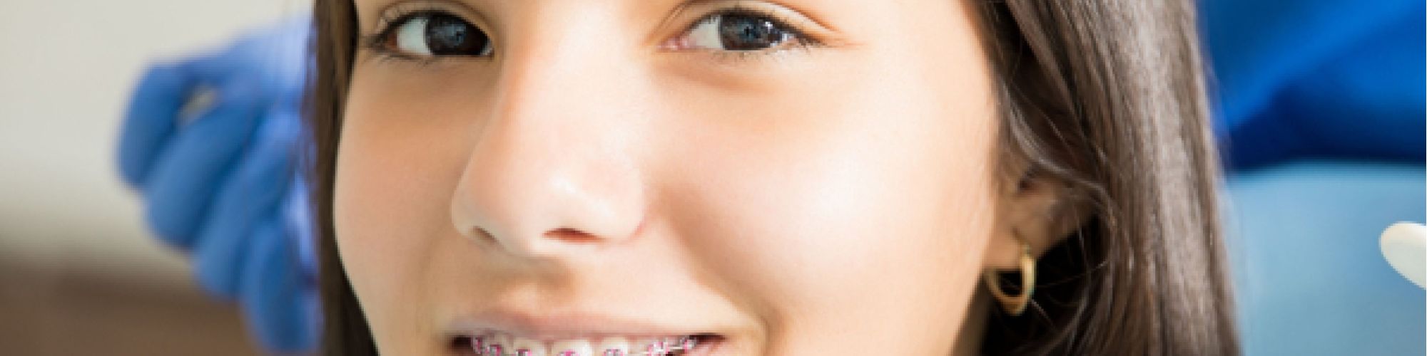 Centra Dental - Living with South Houston Braces: What to Expect in the First Week