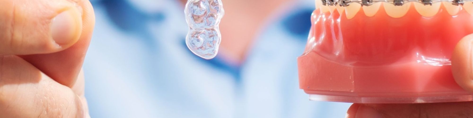 Centra Dental - South Houston Invisalign vs Braces: Which Is More Effective?