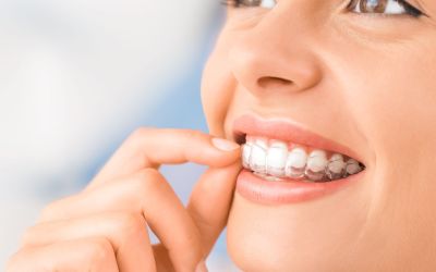 Centra Dental - Best Practices for Dental Hygiene with South Houston Invisalign