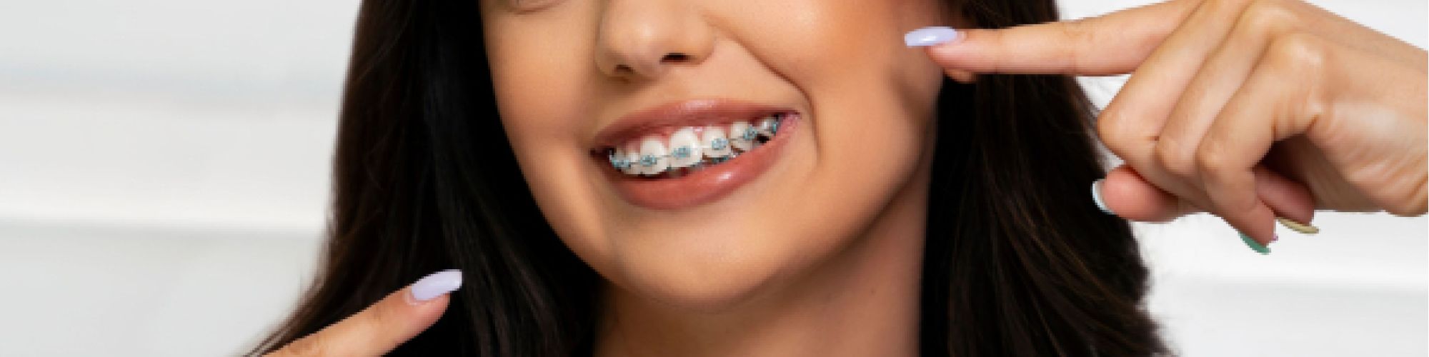 Centra Dental - How South Houston Braces Work to Improve Your Smile