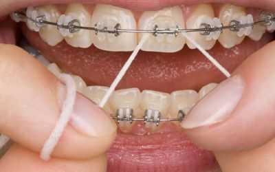 Centra Dental - Dental Cleanings with Houston Braces