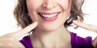 Centra Dental - Can Adults Wear Dental Braces Too?