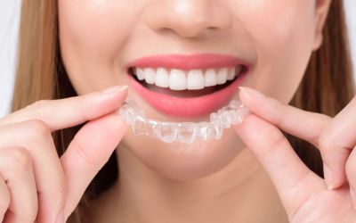 Centra Dental - Invisalign: Discreet South Houston Braces for Adults