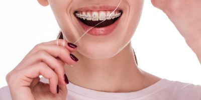 Centra Dental - How to Keep Your South Houston Braces Clean