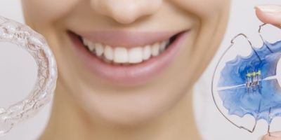 Centra Dental - Does Every Houston Braces Patient Need a Retainer?