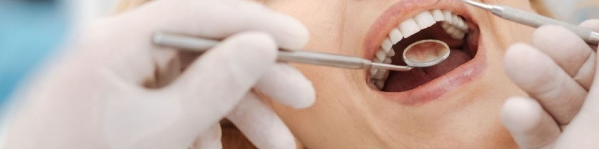 Centra Dental - Have You Booked Your Last Dental Cleaning of the Year With a Houston Dentist?