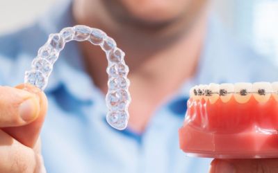 Centra Dental - Are Metal Houston Braces Better Than Ceramic and Invisalign?