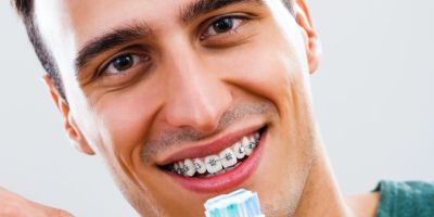 Centra Dental - Keeping Your Teeth Clean While Wearing Houston Braces