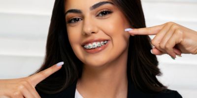 Centra Dental - How South Houston Braces Work to Improve Your Smile
