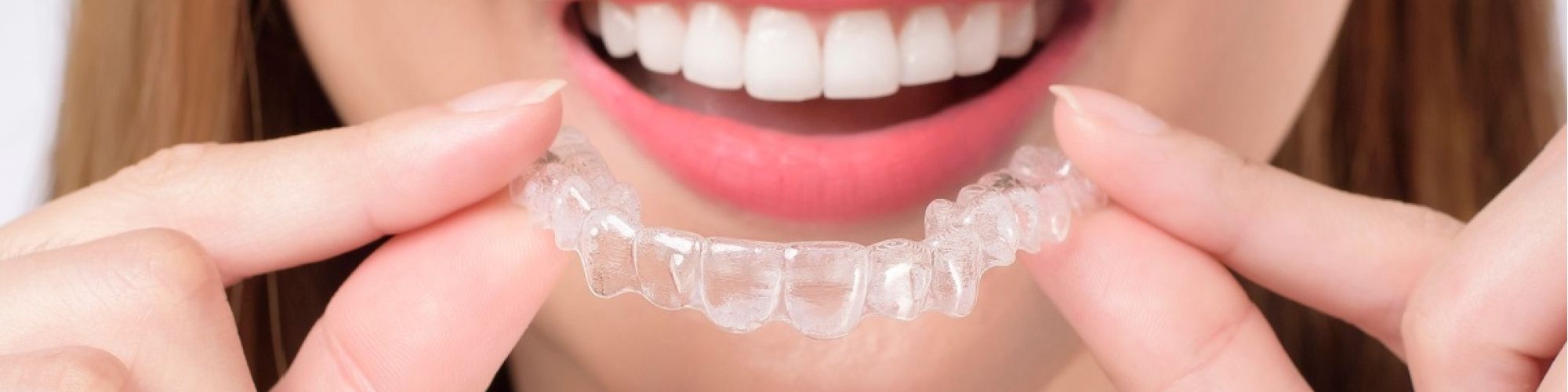 Centra Dental - Invisalign: Discreet South Houston Braces for Adults