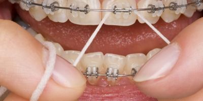 Centra Dental - Dental Cleanings with Houston Braces