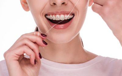 Centra Dental - How to Keep Your South Houston Braces Clean