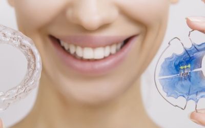 Centra Dental - Does Every Houston Braces Patient Need a Retainer?