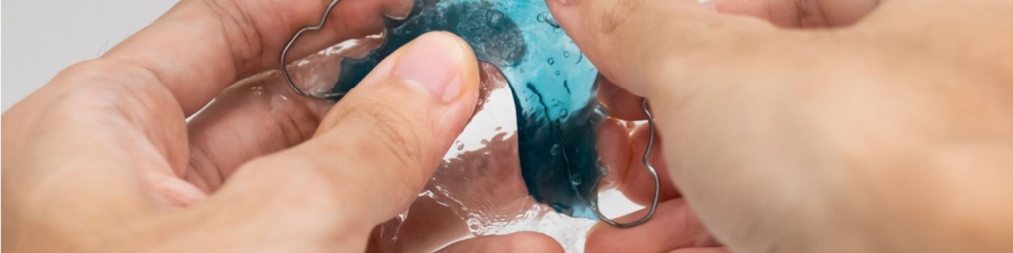 Centra Dental - Does Every South Houston Braces Patient Need to Use Retainers?