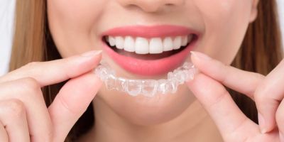 Centra Dental - Invisalign: Discreet South Houston Braces for Adults