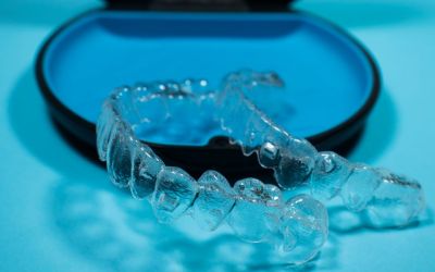 Centra Dental - South Houston Invisalign Do's And Don't's