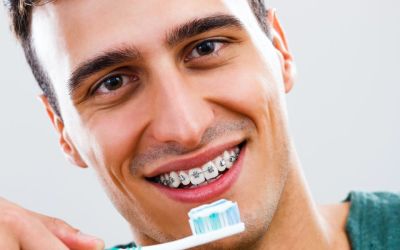Centra Dental - Keeping Your Teeth Clean While Wearing Houston Braces