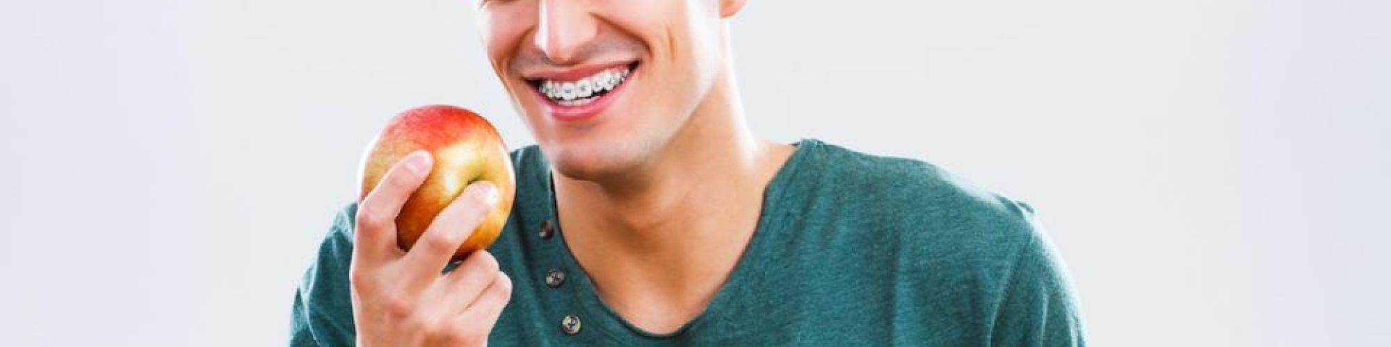 Centra Dental - Foods To Avoid When Wearing Houston Braces