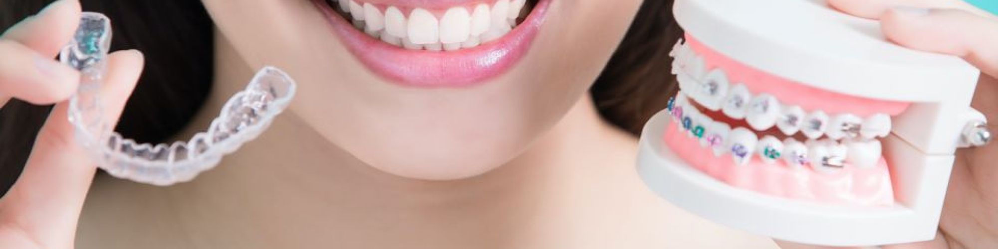 Centra Dental - Are Metal Houston Braces Better Than Invisalign Clear Aligners?