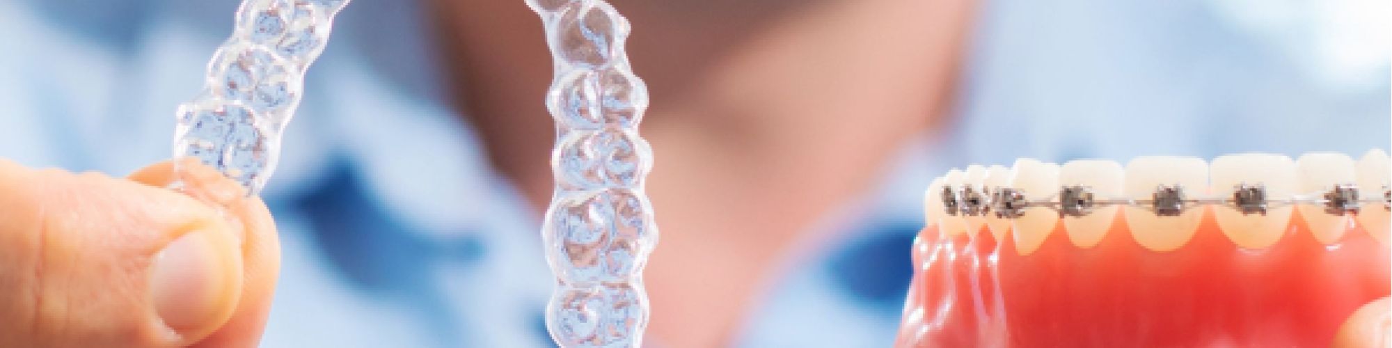 Centra Dental - Are Metal Houston Braces Better Than Ceramic and Invisalign?