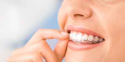 Centra Dental - Best Practices for Dental Hygiene with South Houston Invisalign